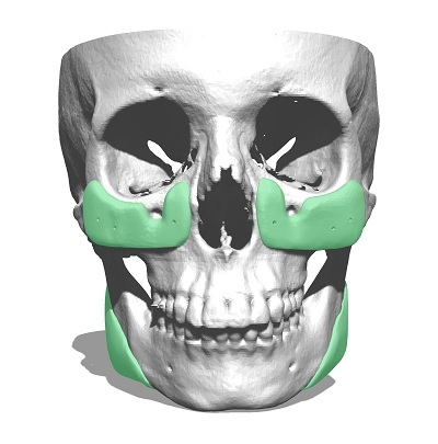 Startup chilena desarrolla implantes cráneo-faciales customizados con tecnología única