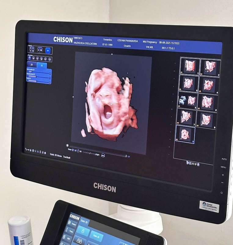 CESFAM de Panimávida cuenta con nuevo ecógrafo para atención prenatal completa