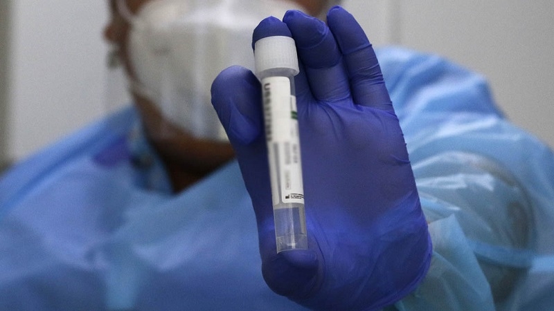Minsal decreta alerta sanitaria por viruela del mono: Hay seis casos confirmados en el país